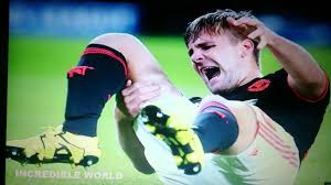 The latest luke shaw injury update has arrived and it isn't a positive one for manchester united. Luke Shaw Double Leg Break Vs Psv Eindhoven Youtube