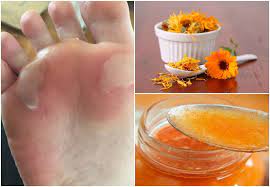 Como Curar Las Ampollas De Los Pies Usando 5 Soluciones Caseras Mejor Con Salud