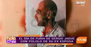 437 likes · 2 talking about this. Los Detalles De La Violenta Pelea De Sergio Jadue En Miami