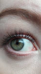 Keratosis pilaris is a bumpy rash that affects the back of the arms, front of the thighs, cheeks, and buttocks. Re Under Eye Bumps Not Milia Page 3 Beauty Insider Community