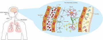 Jun 20, 2021 · član olimpijskog tima ugande prvi je sportista koji je na testiranju po dolasku u japan, na tokijskom aerodromu narita, bio pozitivan na korona virus. Frontiers Neurologic Alterations Due To Respiratory Virus Infections Cellular Neuroscience