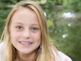 1 of transparent aligners for thousands of dentists and orthodontists. How Much Do Braces Cost Getting The Priceless Smile No Gaps Dental