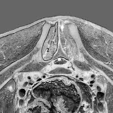 Darkwing 1,466 followers · 13 following. Pdf Back And Pelvis