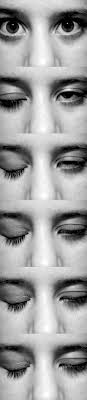 Bells Palsy Bells Palsy Physical Therapy Funny Faces