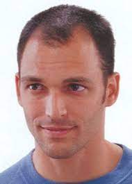 Hairstyles For Short Thin Hair Lilostyle Thin Hair Men Short Thin Hair Hair Loss Men