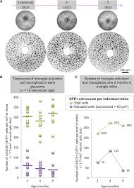 Zhenjiang great wall group co.,ltd. In Vivo Dynamics Of Retinal Microglial Activation During Neurodegeneration Confocal Ophthalmoscopic Imaging And Cell Morphometry In Mouse Glaucoma Protocol Translated To German