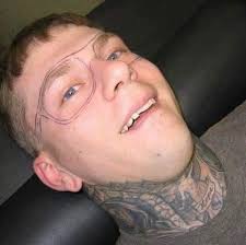 This guy got glasses tattooed, Atleast he won't ever lose them... 😬😅