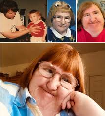 Remembering former child actress with disability