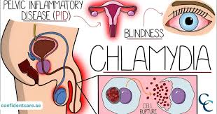 Image result for chlamydia symptoms