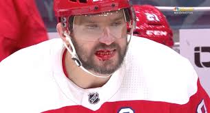 And when that hockey player smiles, he must be missing teeth, right? Alex Ovechkin S Mouth Bloodied After High Stick From Miles Wood Scores Revenge Goals Minutes Later