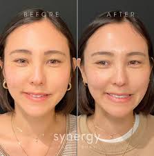 Laura Cady BSN, RN, CANS