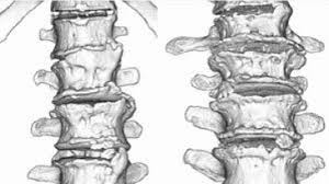 Maybe you would like to learn more about one of these? Zvezda Seriala Tatyanin Den Uzhasnul Vneshnim Vidom Menya Otravili Vesil 40 Kilogrammov Novosti Na Kp Ua