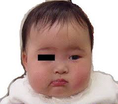 We did not find results for: West Syndrome Associated With Mosaic Down Syndrome Sciencedirect