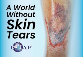 Image result for Skin Tear