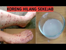 Pin Di Skinker