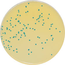 Department of basic sciences, college of veterinary medicine, mississippi state university, p.o. Pp7021 Colorex Listeria Iso E O Laboratories Ltd