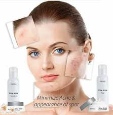 Pemakaiannya pun harus dilakukan rutin selama minimal 3 bulan. Review Ertos Why Acne Harga Sih Murah Tapi Manfaatnya Gimana