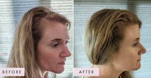 New Study Shows Hair Gain Hair Capsules Deliver Amazing Results