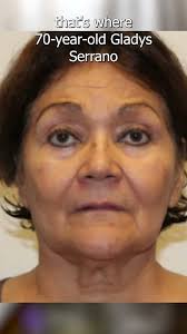 Long Island woman charged with practicing unlicensed dentistry out of  apartment kitchen