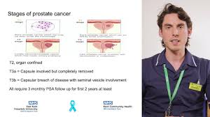 Psa is a substance your prostate makes. Specificites Geriatriques Du Cancer De La Prostate Prostate Cancer Nhs