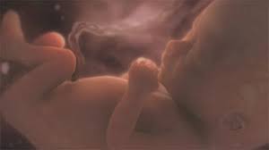 Other intersex people, activists, supporters and academics have contested the adoption of the terminology, seeing it as. Body Parts What It Means To Be Intersex Identiversity