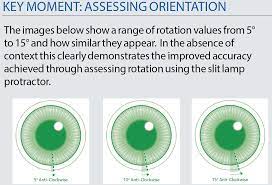Remember, both contacts and glasses that are prescribed for multiple distances are a compromise, but one that works well for most people. How To Get Used To Toric Contact Lenses