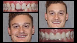 New York Center for Cosmetic Dentistry