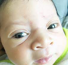 A dominance of one copy of the gene over the other means that the dominant copy has an effect you can see, in this case, you can see that the person has brown eyes. When Does Newborn Baby Eye Color Change Newborn Baby