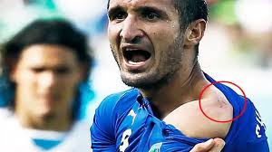 Luis Suarez Soal Gigitan ke Chiellini: Tak Usah Dibesar-besarkan