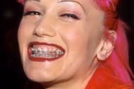Learn about gwen stefani's age, height, weight, dating, husband, boyfriend & kids. 7 Celebs Who Faced The Horror Of Adult Braces The Daily Edge