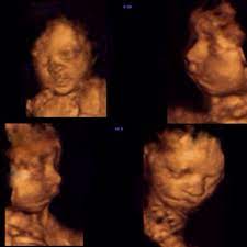 4d ultrasound pictures at 27 weeks. 4d Ultrasound At 27 Weeks Would Love To See Yours September 2014 Babycenter Australia