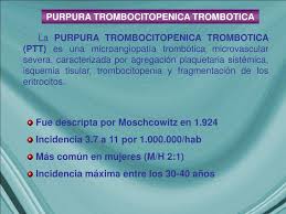 The photograph shows two types of bruising that are children who have bleeding symptoms, other than merely bruising (purpura), usually are. Ppt Purpura Trombocitopenica Trombotica Powerpoint Presentation Free Download Id 6333941