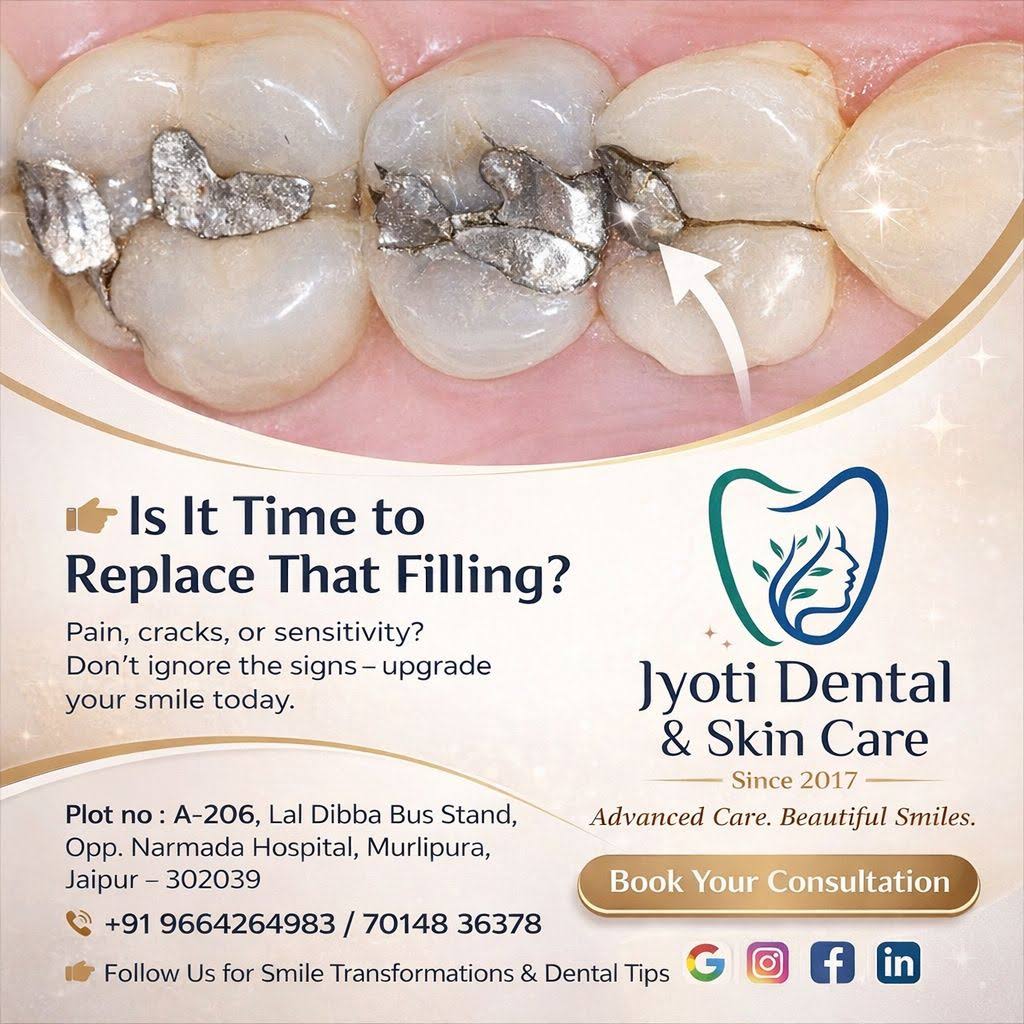 Dental Filling product image