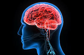Tra le cause principali di una emorragia cerebrale ci sono traumi cerebrali o ipertensione cronica. Trattamento Aneurisma Cerebrale Prof Antonino Raco