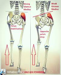Image result for Functional Leg Length Discrepancy