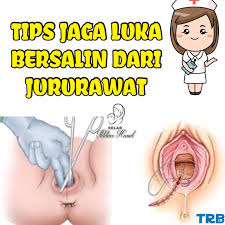 Menko polhukam wiranto diketahui terkena luka tusuk di usus. Tips Jaga Luka Bersalin Luka Kelab Ikhtiar Hamil Facebook