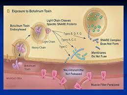 Comprehensive major review articles, written by experts and stringently refereed, integrate the literature on subjects selected for their clinical importance. Clostridium Botulinum Prepared By Shiekha Al Aujan Ppt Download