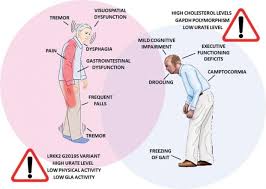 Based on this data, you and your care team will create a. How And Why Does Parkinson S Disease Affect Women And Men Differently Journal Of Parkinson S Disease