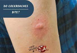 Do Cockroaches Bite Information And Facts Pest Samurai