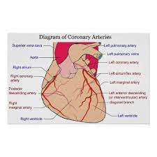 Image Result For Poster Of Coronary Arteries Of Human Heart Coronary Arteries Arteries Coronary