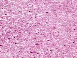 Wharton Jelly The Mucous Connective Tissue Constituting The Core Of A Human Umbilical Cord Lm X64 Photographic Print Gladden Willis Allposters Com