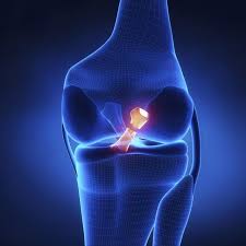 Exercises For A Torn Knee Ligament Livestrong Com Knee Ligaments Acl Surgery Acl Tear