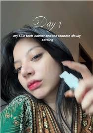 Damon's Makeup-Free Look and Swimming Pool Fun