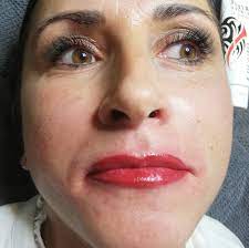 Kunden Vorher Nachher Permanent Make Up Microhaarpigmentierung