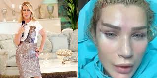 Maybe you would like to learn more about one of these? Seda Sayan Bir Kez Daha Yuzunu Gerdirdi