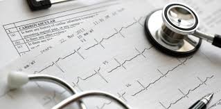 Acelea cu originea la nivelul camerelor inferioare ale. Aritmie Sau Palpitatii Cum Le Diferentiem