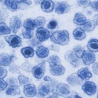 Judy mikovits joins stew peters to discuss the specifics surrounding the shots being called 'vaccines', and how it's been. Court Rules Against Mikovits The Scientist Magazine