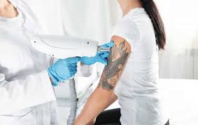 This is an exfoliating technique used to remove scars, acne, tissue irregularities, as well as tattoos in some cases. Can A Tattoo Be Removed Naturally Saved Tattoo