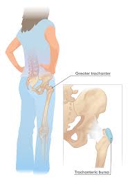 When these muscles get tight, as they often do, you may find that along with hip pain, your lower back hurts—but you can't figure out why. Hip Pain After Running Causes Pain Relief Prevention