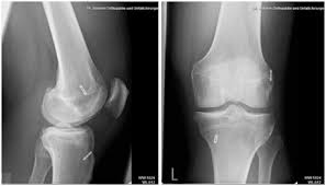 Privatpraxis Fur Orthopadie Und Unfallchirurgie Dr Med Andre Sintenis In Landsberg Am Lech